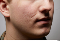  HD Face Skin Casey Schneider cheek chin face lips mouth nose scar skin pores skin texture 0001.jpg
